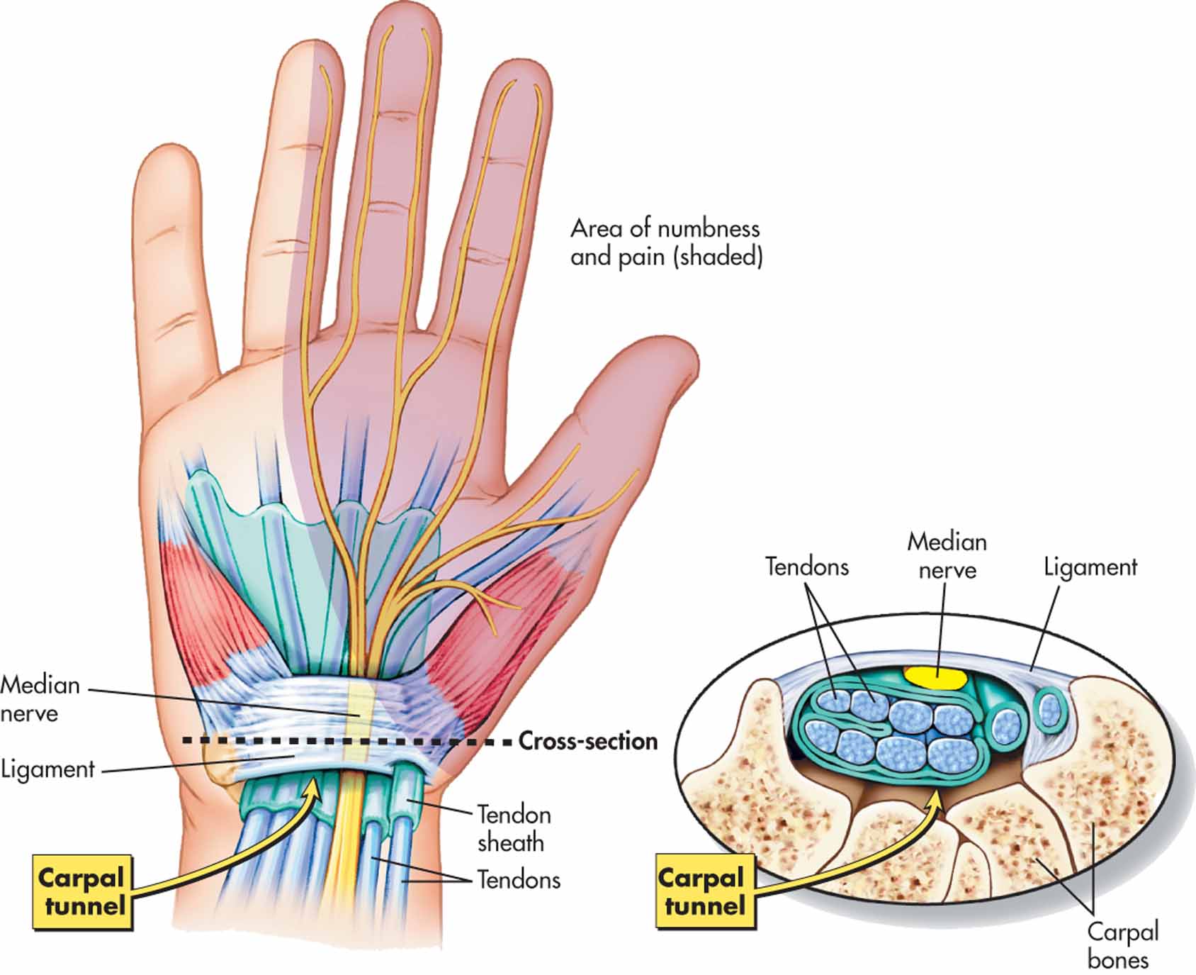 carpal-tunnel-syndrome-cts-cause-pathophysiology-and-treatments