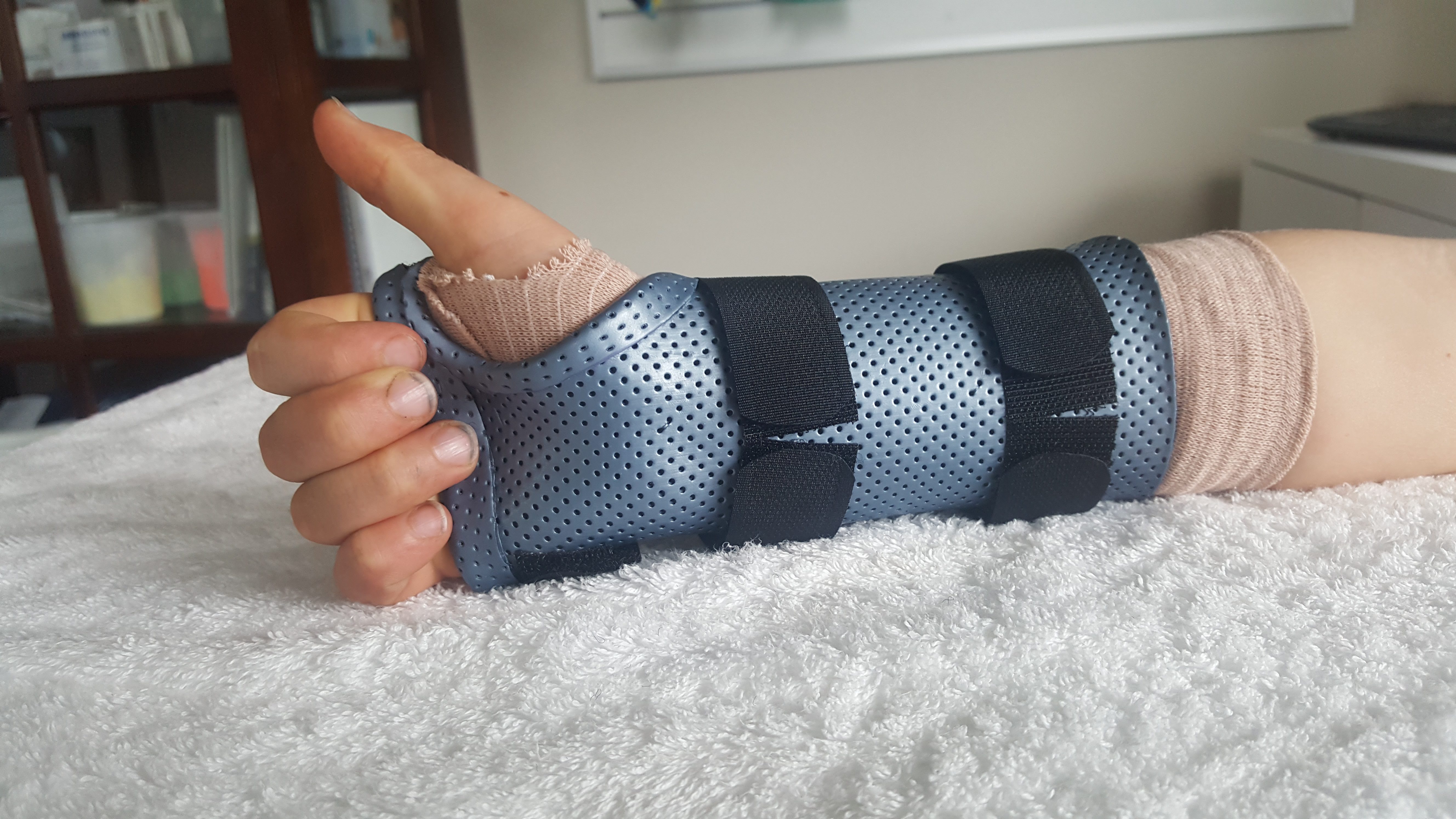 buckle fracture splint